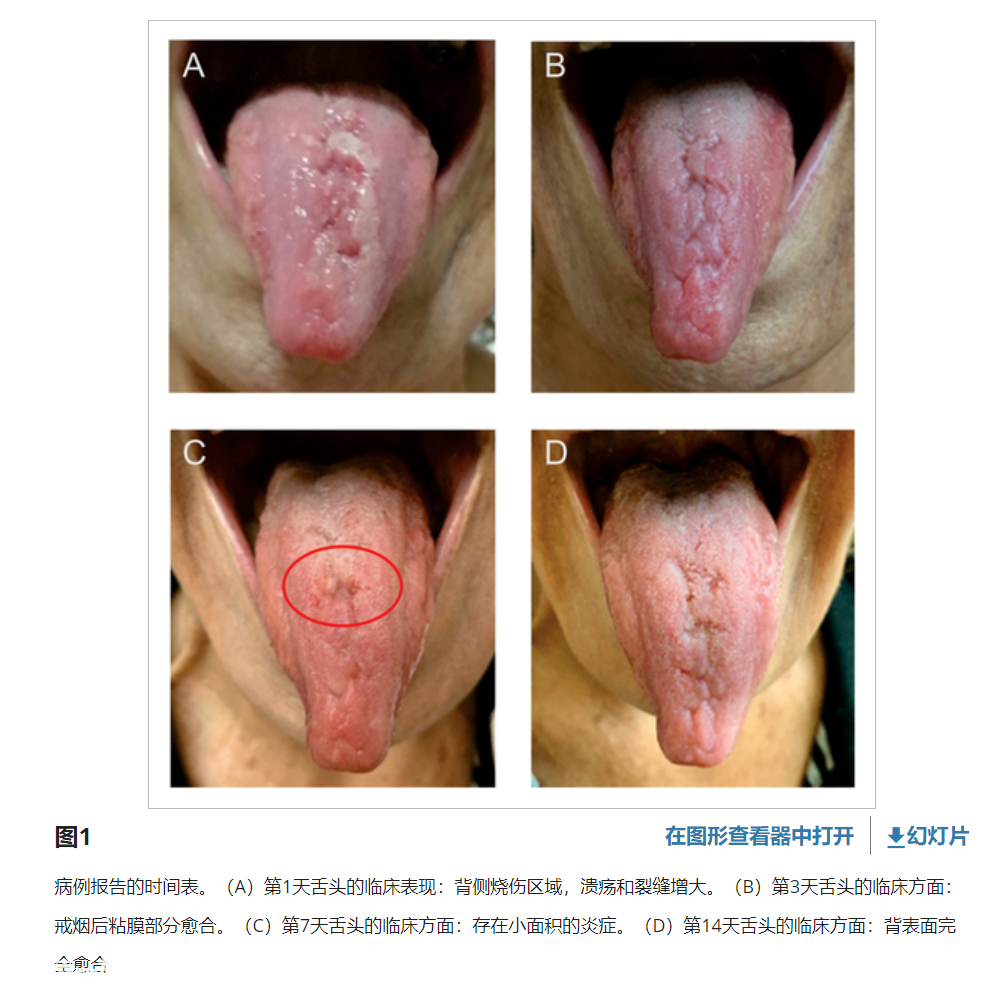 为了不变“小阳人”疯狂吃蒜?不可行!-图片1